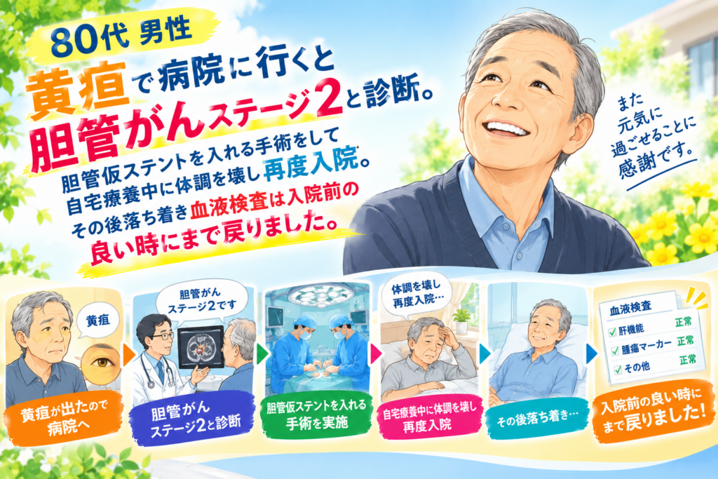 実例　80代　男性　胆管がん　ステージ２